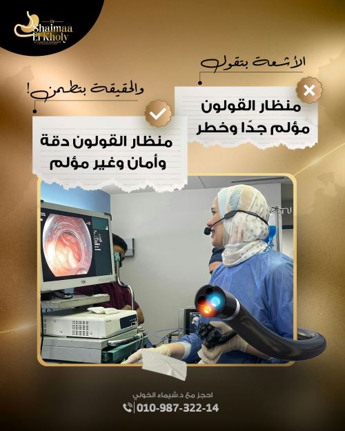 مميزات استئصال أورام القولون بالمنظار